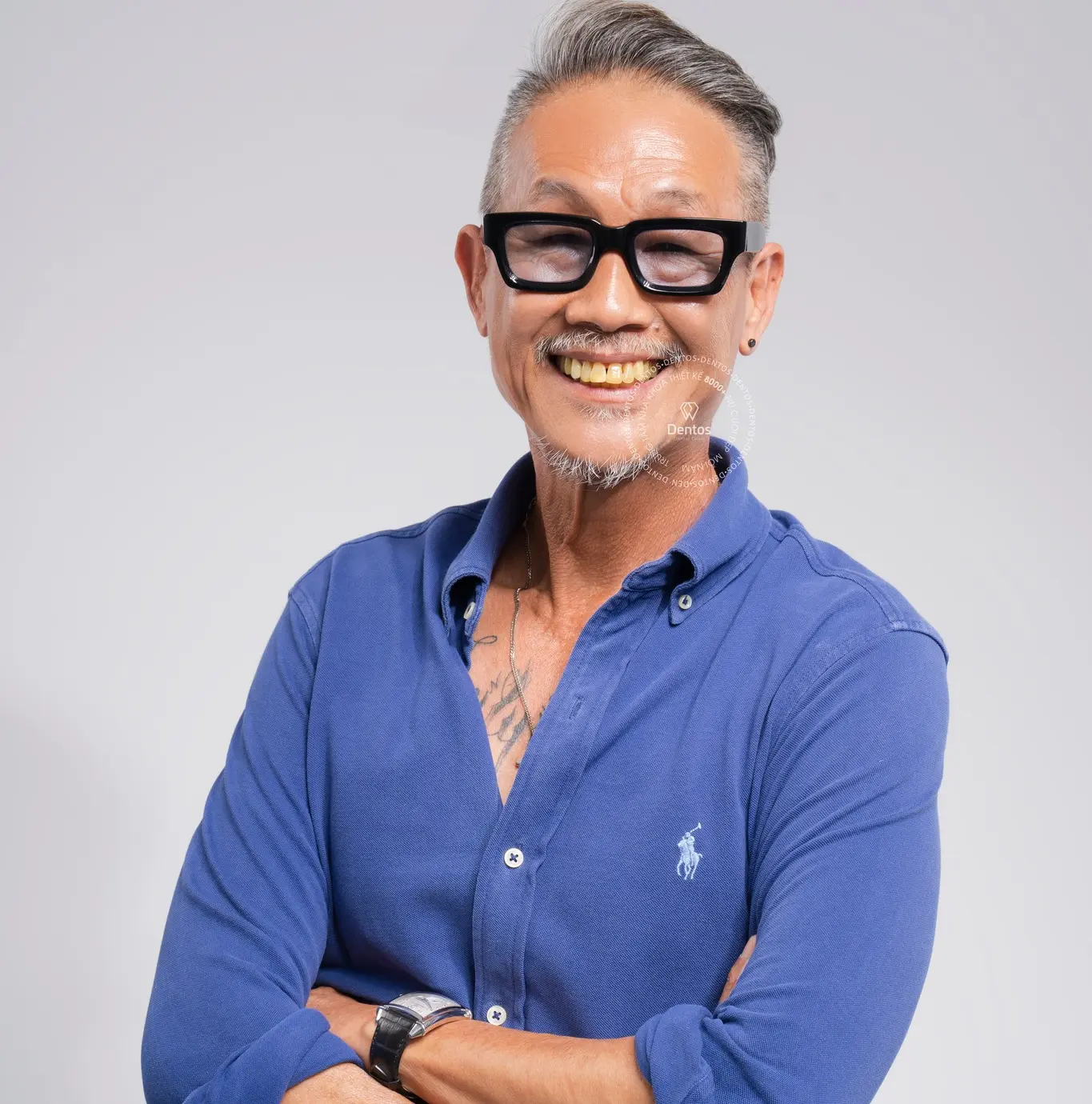 Răng của người cao tuổi thường bị yếu và mất dần tính thẩm mỹ